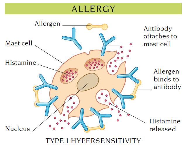 allergy