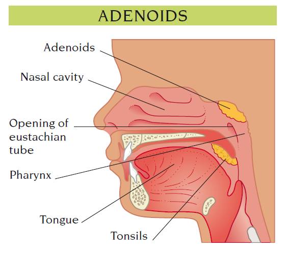 adenoids