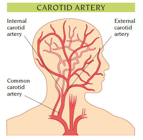 carotid artery